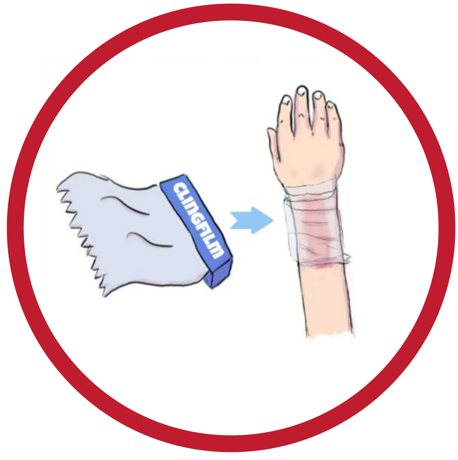 Cover burn with loose strips of clingfilm
